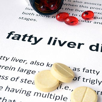 Heavy drinking, hepatitis, and medications can all cause abnormal liver test results.