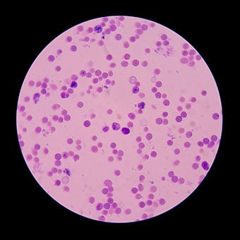 Blood tests can be performed to determine how well your liver is functioning.