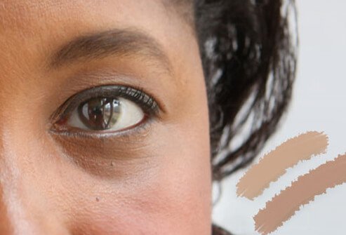 Use concealer to reduce the appearance of dark under eye circles. 