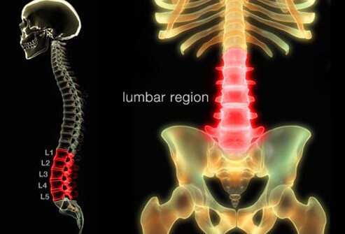 Nearly everyone will experience some form of back pain in his or her lifetime.
