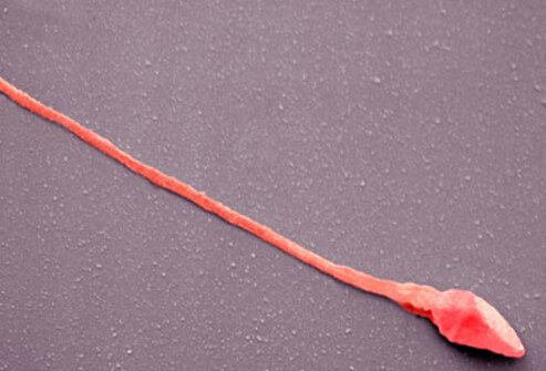 A human sperm, low testosterone affects fertility.