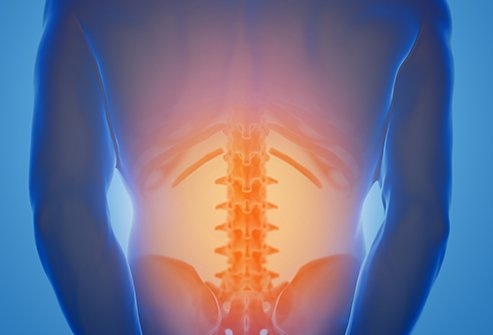 Discectomy vs Laminectomy Discectomy vs Laminectomy