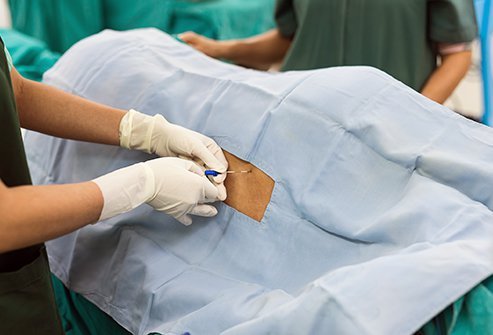A lumbar puncture or spinal tap procedure provides lifesaving information in disease diagnosis.