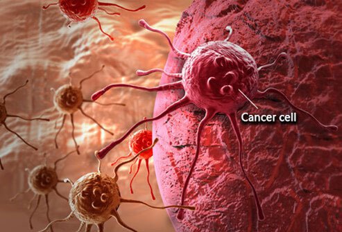 Approximately 1.5 million new cancer cases are diagnosed in America every year.