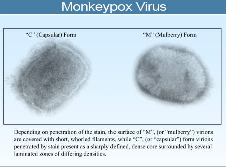 Monkeypox virus, brick-shaped negative stained virus grown in tissue cultures, visualized by electron microscopy Monkeypox virus, brick-shaped negative stained virus grown in tissue cultures, visualized by electron microscopy