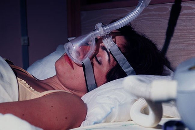 The most common treatment for obstructive sleep apnea is a CPAP machine.