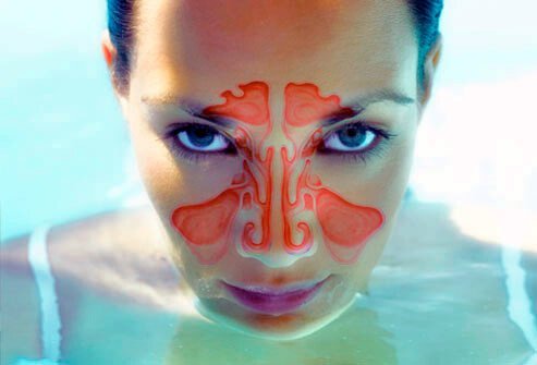 Sinuses are defined as air pockets behind the cheeks, forehead, nose, and eyebrows.