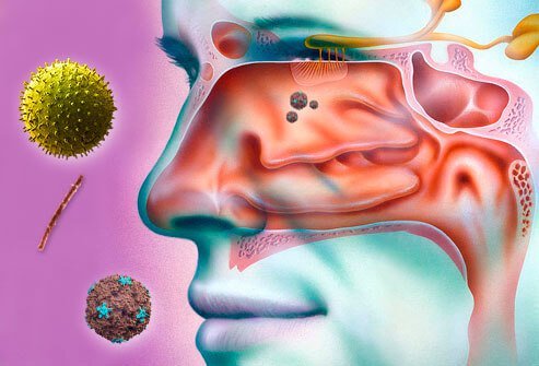 Sinus problems can be caused by temperature changes, allergies, smoking, illness, and other causes.