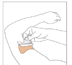 Apply the sticky half of your NEUPRO patch - Illustration Apply the sticky half of your NEUPRO patch - Illustration