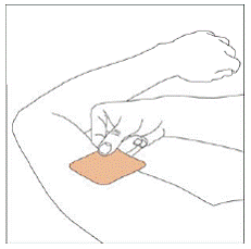 Apply the sticky half of your NEUPRO patch - Illustration Apply the sticky half of your NEUPRO patch - Illustration