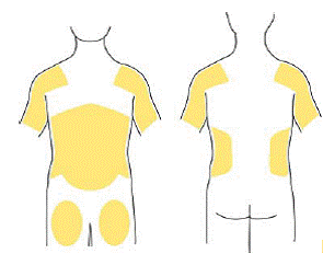 Application area - Illustration Application area - Illustration