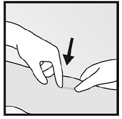 Mark the distal end - Illustration Mark the distal end - Illustration