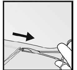 Gently insert a forceps into the incision - Illustration Gently insert a forceps into the incision - Illustration