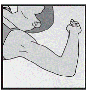 Positioning the woman - Illustration Positioning the woman - Illustration