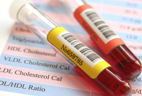 Nordic eating may lead to better cholesterol levels. 