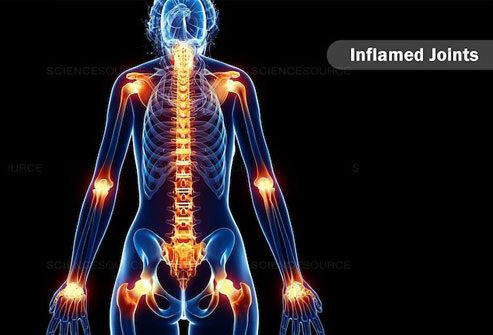 The Nordic diet is an anti-inflammatory diet.
