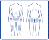 Pull the needle out of your skin. After
that, you may see a drop of NovoLog at the needle tip. This is normal and does
not affect the dose you just received - Illustration
