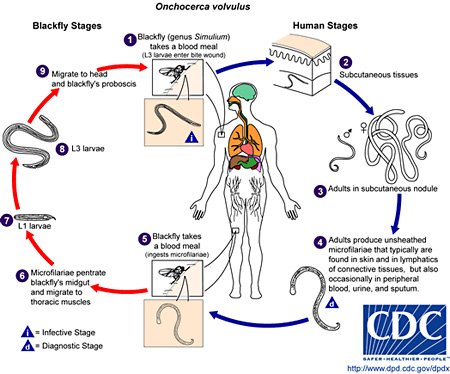 Picture of the life cycle of O. volvulus