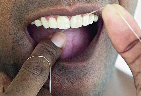 Daily brushing of teeth, along with rinsing and flossing (removing substances trapped between teeth with dental floss) is good.