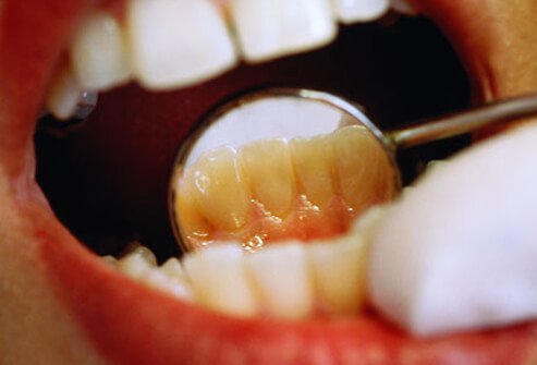 Visit your dentist regularly.