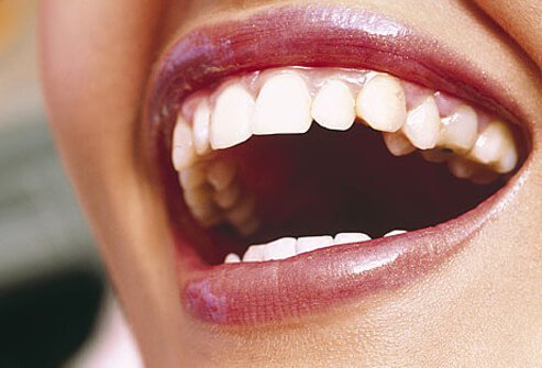 As you age, consuming certain foods and drinks can stain your teeth.