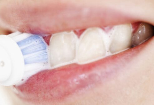 Most regular toothpastes, gels, and liquids may remove some stains, but most do not contain the bleaches mentioned above, so they may have little or no effect in making your teeth whiter.