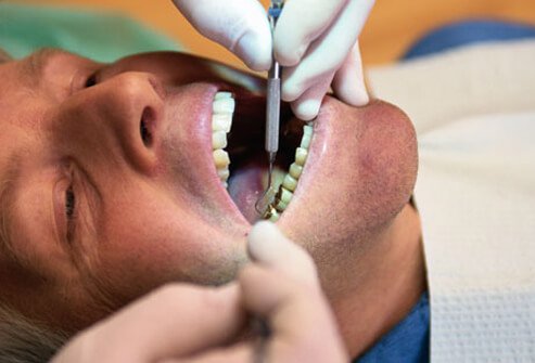 Whiteners work on natural teeth but not on other manufactured or altered teeth.