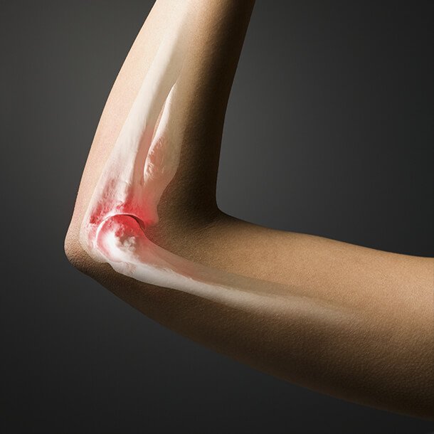 Joint Pain