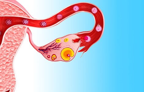 Sometimes a follicle does not release an egg during ovulation, and instead it continues to fill with fluid inside the ovary.