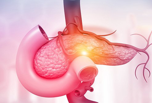 What is the most common pancreatic neuroendocrine tumor