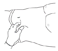 Insert needle fully into the
subcutaneous tissue - Illustration