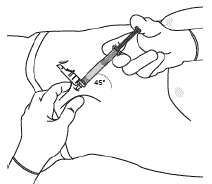 Withdraw the needle at the same
angle used for insertion and release pinched skin - Illustration