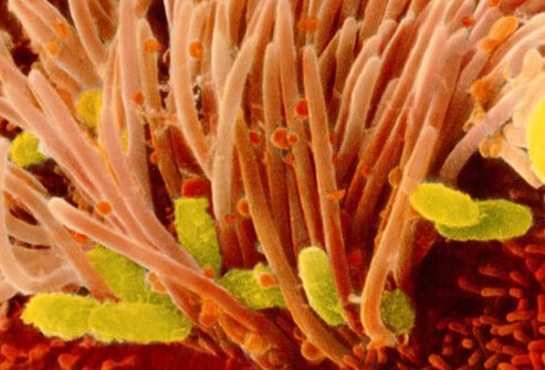 It stays in the upper airways and interferes with the body's ability to clear airway secretions by infecting the cells needed for this function.