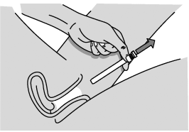 Gently remove the plunger rod and pre-filled applicator from the vagina - Illustration