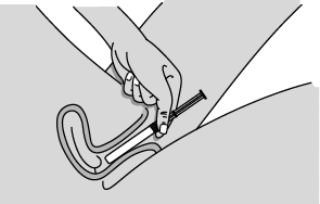 Gently insert the pre-filled applicator into the vagina as far as it will comfortably go while you continue to hold it by the grooved area firmly - Illustration