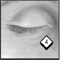 How to use PILOPINE HS - illustration 4