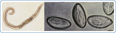 Picture of pinworm and pinworm eggs (magnified)
