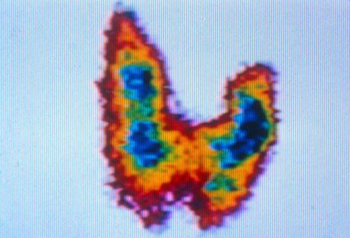 Rule out thyroid disorders and other health problems. 