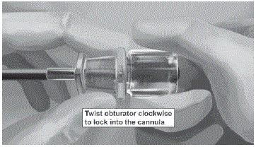 Always verify the presence of each implant by
palpation of the patientâ€™s arm immediately after the insertion - Illustration