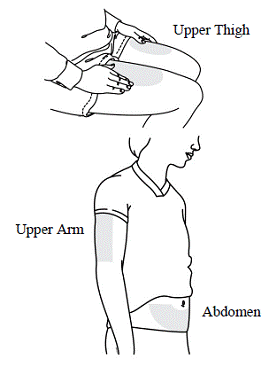 Choose an injection site - Illustration Choose an injection site - Illustration