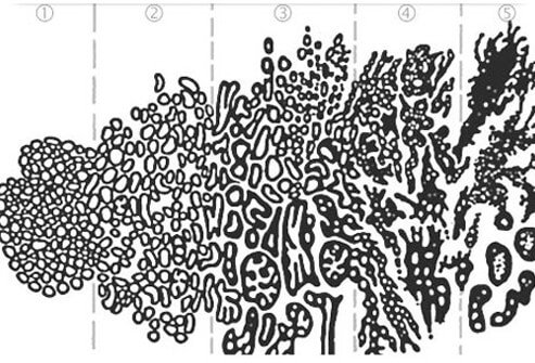 Photo of gleason diagram.