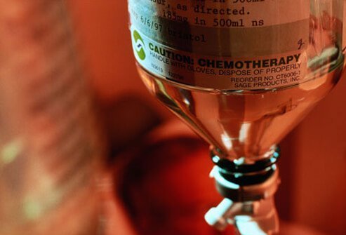 Photo of chemotherapy treatment for prostate cancer.