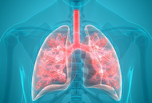 An upper respiratory infection results in inflammation in the nose, throat, sinuses, larynx and pharynx often due to cold viruses. You may need to see a doctor for an upper respiratory infection if you develop a fever, pain, sore throat or symptoms of a bacterial infection.