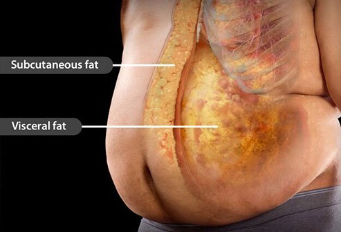 Visceral fat around organs increases the risk of high blood pressure, diabetes, and heart disease.