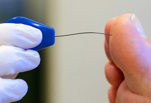 This means damage to the nerves that connect your spinal cord to your arms, legs, hands, and feet.