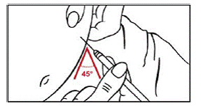 Insert the full length of the needle into the skin at a 45-degree angle with a quick “dart-like” motion - Illustration