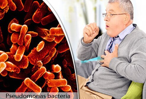 Bronchitis is a condition whereby the bronchi become inflamed.