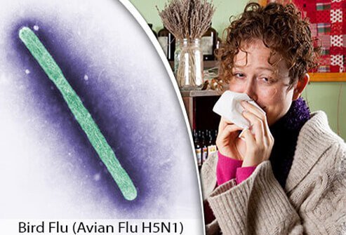 Bird Flu (Avian Flu H5N1) 