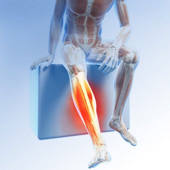 An illustration portraying leg pain caused by restless leg syndrome (RLS).