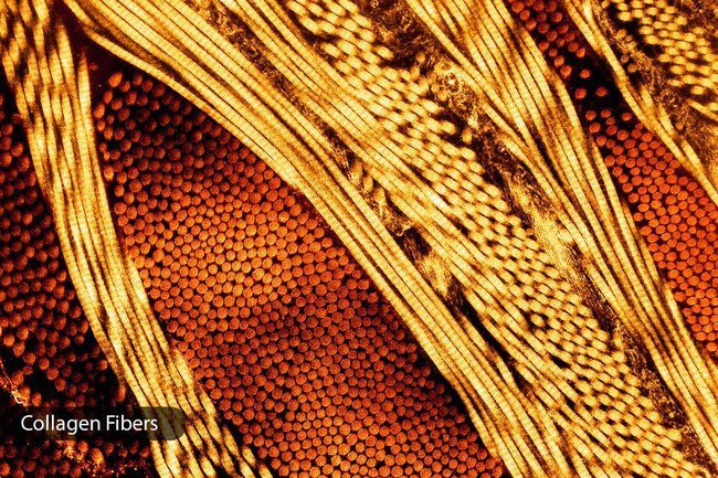 Retinoids trigger your body to make more collagen.